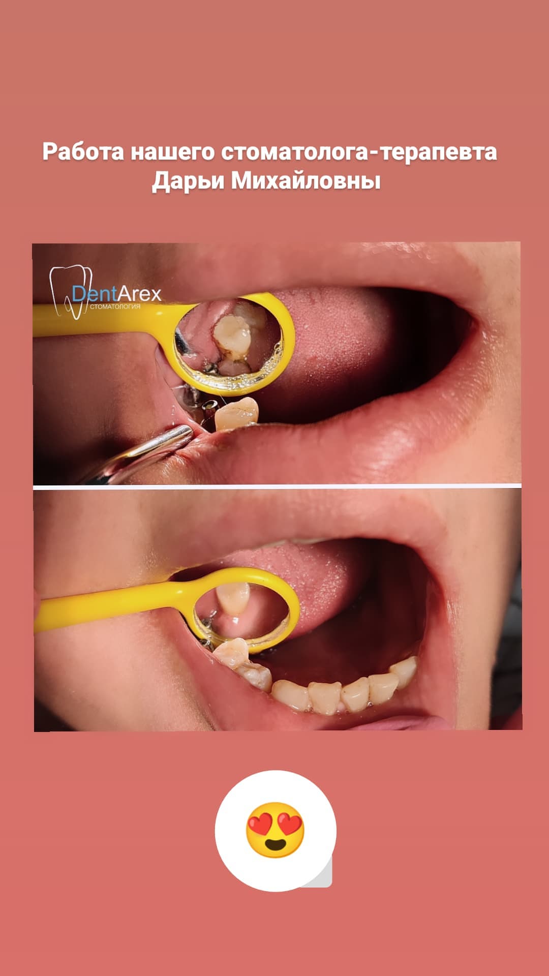 До/после — хирургия