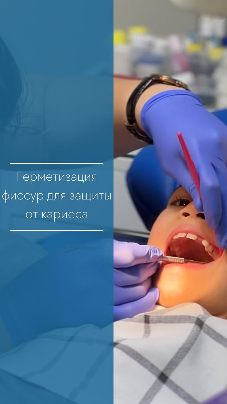 Защита от кариеса