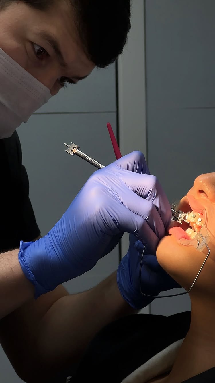 Ортодонтия — признаки для визита